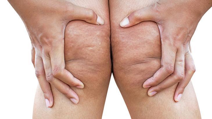 lipodem kadinlarin sessiz cigligi neden kilo veremiyorum diyenler icin cevap sX3MurYz.jpg